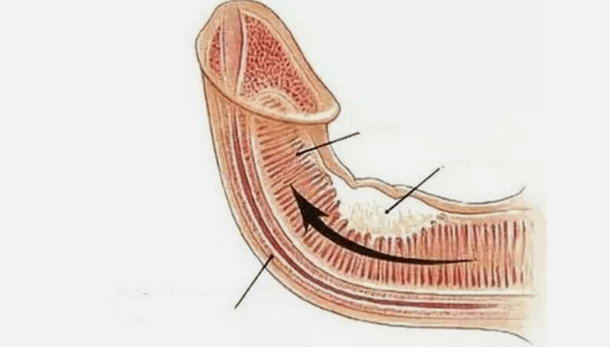 Eliminating venous outflow